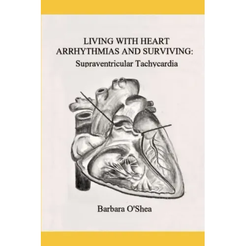 Living with Heart Arrhythmias and Surviving: Supraventricular Tachycardia